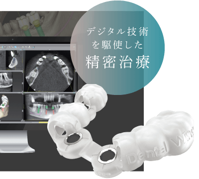 デジタル技術を駆使した精密治療