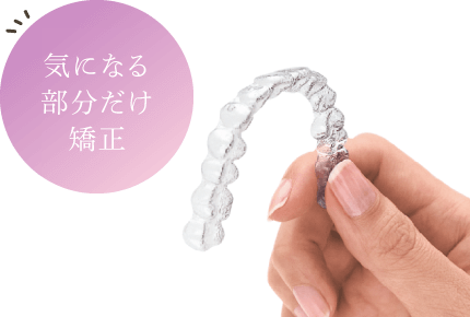 気になる部分だけ矯正