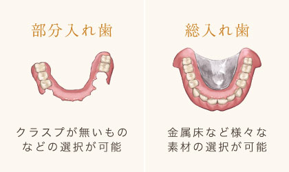 <部分入れ歯>クラスプ(留め具)が無いものなどの選択が可能 <総入れ歯>金属床など様々な素材の選択が可能