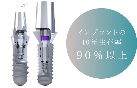 インプラントの10年生存率:90%以上