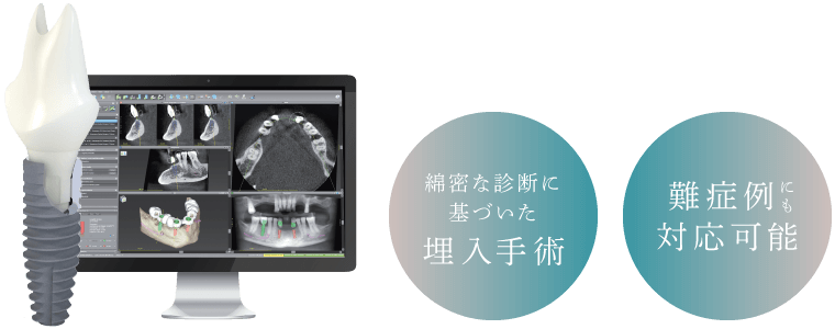 綿密な診断に基づいた埋入手術、難症例にも対応可能