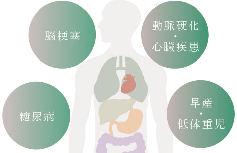 脳梗塞、動脈硬化・心臓疾患、糖尿病、早産・低体重児